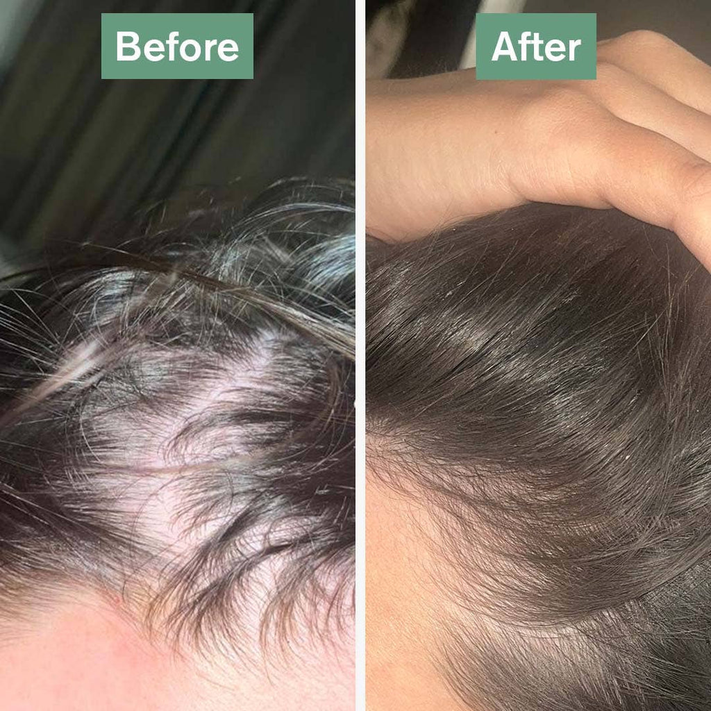 Hair Saviour® | 60 Capsules | Healthy Hair Growth | AnaGain