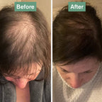 Hair Saviour® | 60 Capsules | Healthy Hair Growth | AnaGain