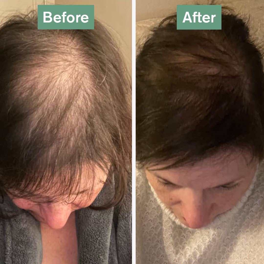 Hair Saviour® | 60 Capsules | Healthy Hair Growth | AnaGain